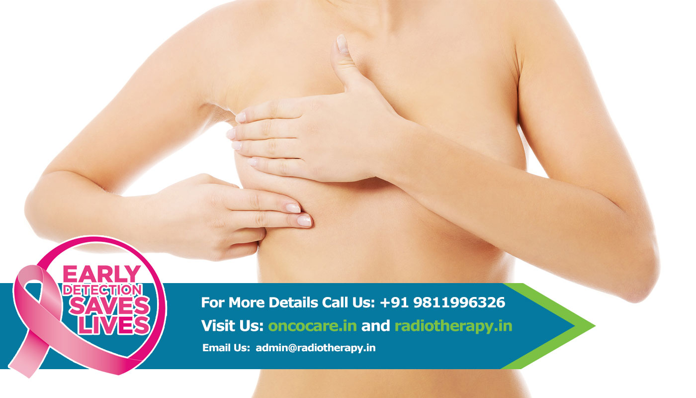 Breast Cancer Treatment in Delhi