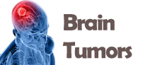 Brain Tumors