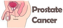 Prostate Cancer