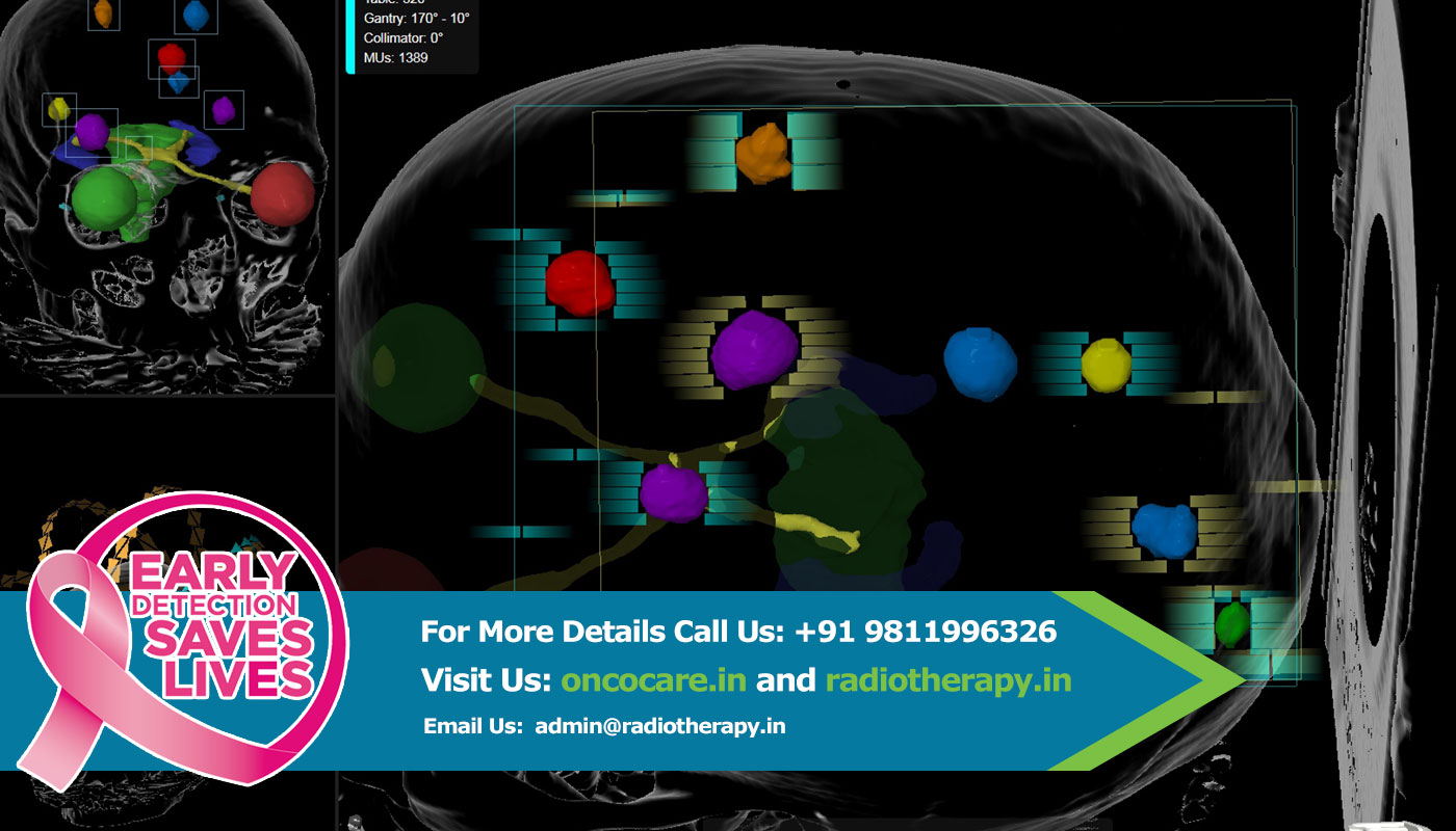 Tumor Treatment in  india  